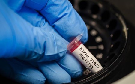 Pakar Peringatkan Ancaman Virus Nipah, Indonesia Diminta Tingkatkan Kewaspadaan